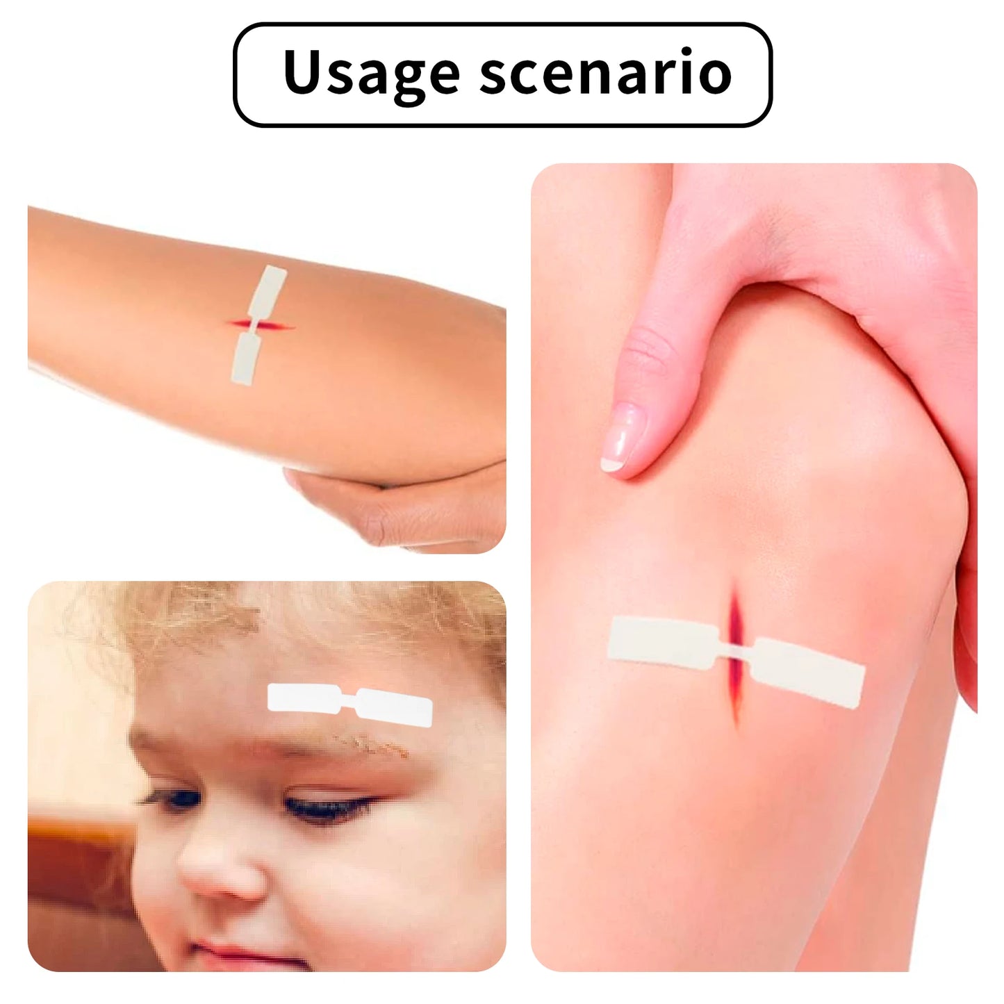 WATERPROOF WOUND CLOSURE