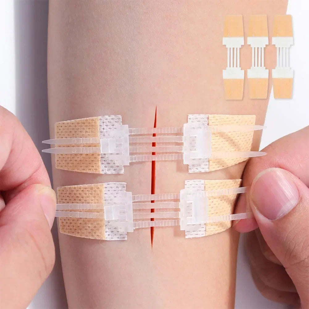 ZIPPER WOUND PATCH