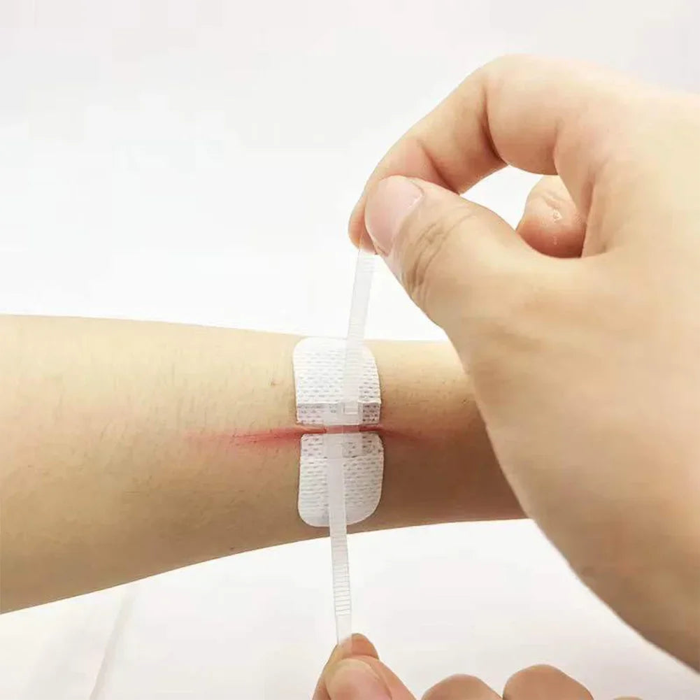 ZIPPER WOUND PATCH