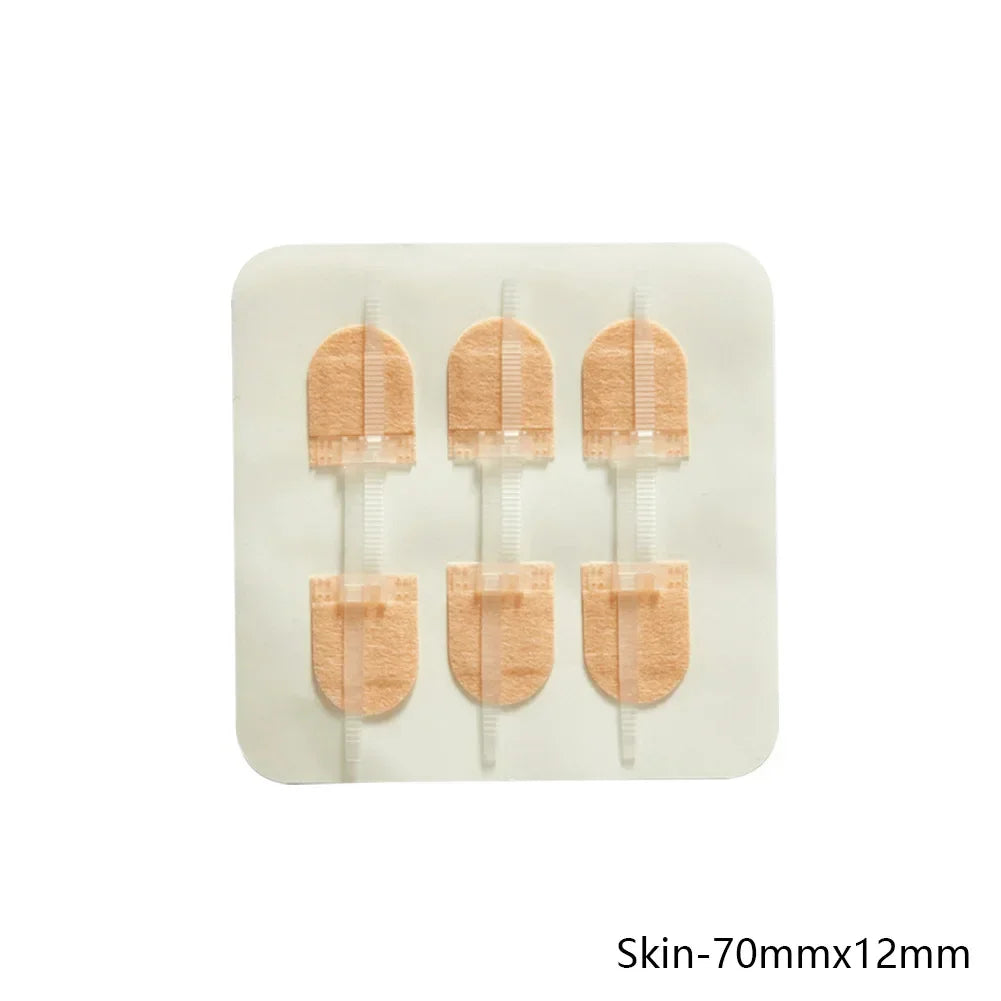 ZIPPER WOUND PATCH