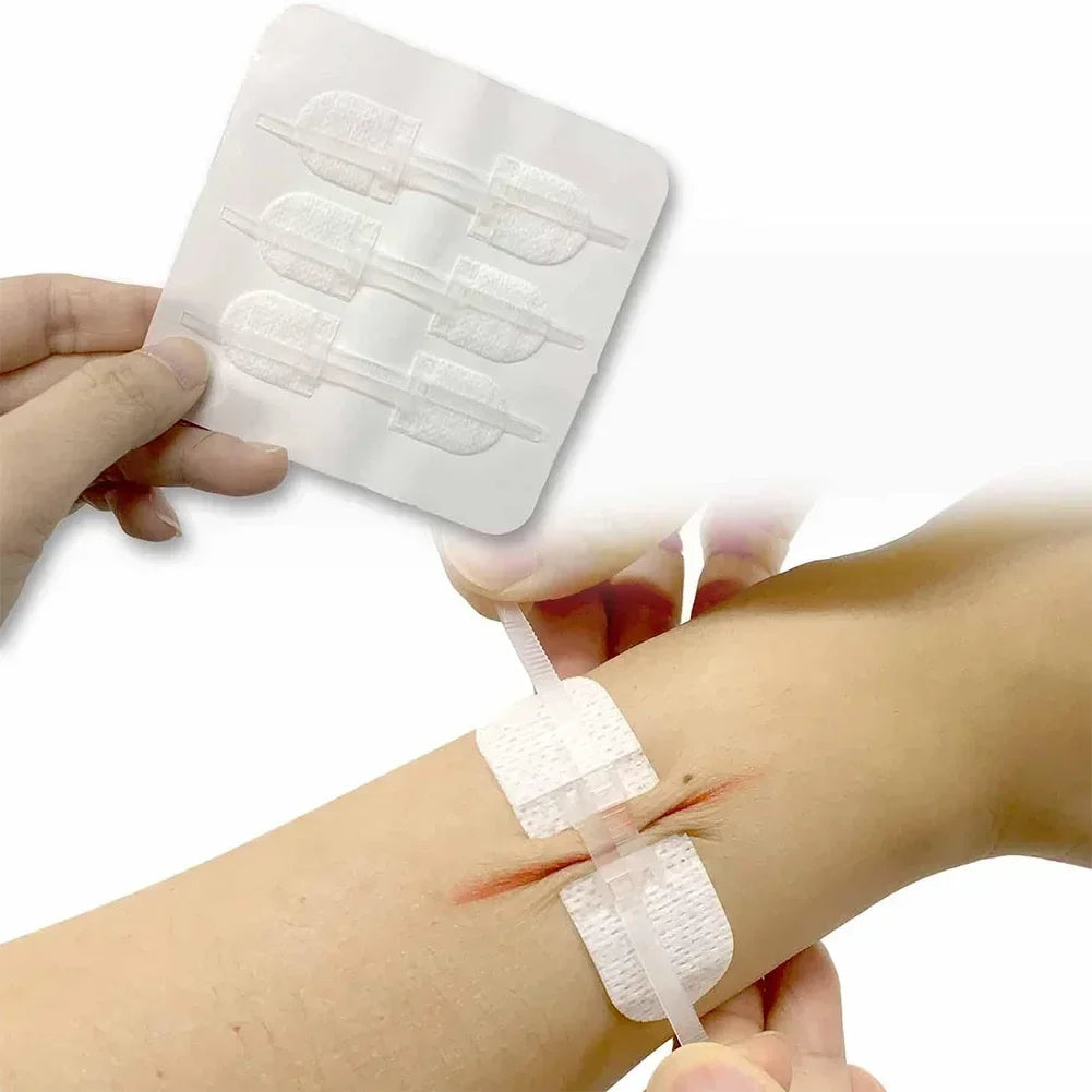ZIPPER WOUND PATCH