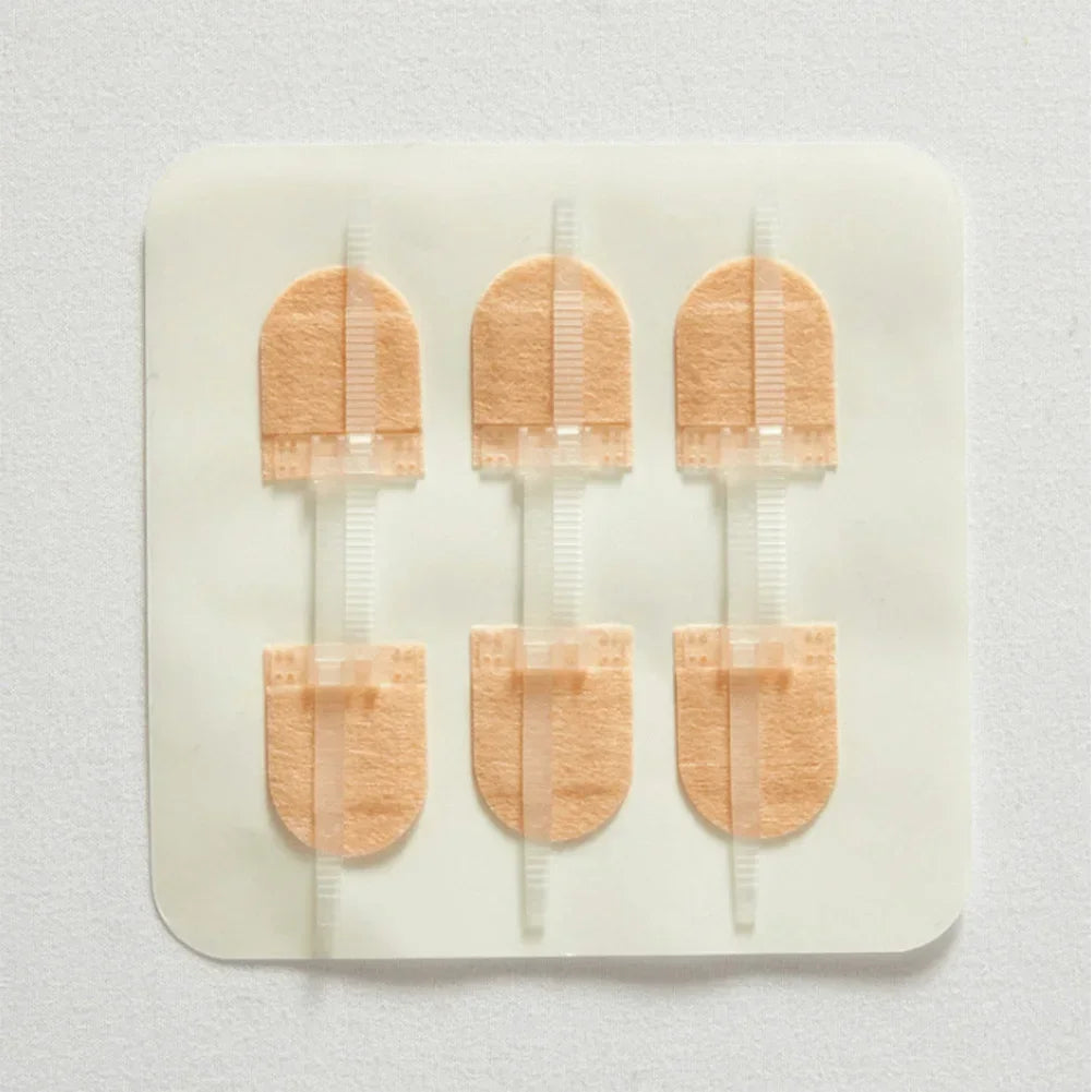 ZIPPER WOUND PATCH