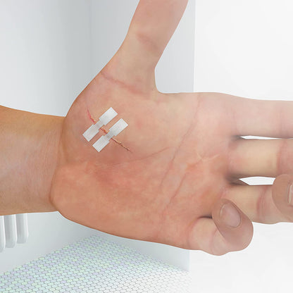 WATERPROOF WOUND CLOSURE
